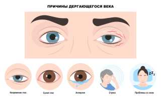Причины подёргивания правого глаза и методы лечения для улучшения состояния
