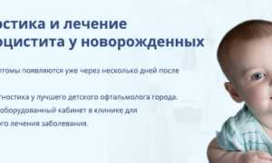 Причины и лечение дакриоцистита у новорождённых: важные аспекты
