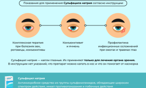 Применение глазных капель Альбуцид у детей: полезные советы и рекомендации