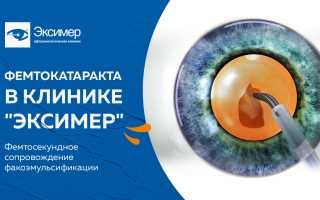 Лечение катаракты лазером — особенности и цены на процедуры