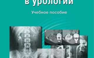 Современные рентгенологические методы исследования в урологии