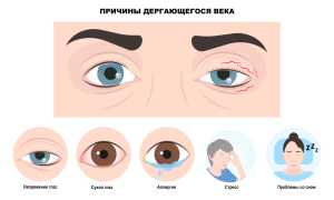 Что означает, если дёргается левый глаз: причины и последствия