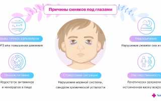 Почему у грудничков появляются синяки под глазами и что с этим делать