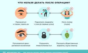 Особенности послеоперационного периода после замены хрусталика глаза при катаракте: важные рекомендации и советы
