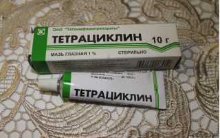Применение Тетрациклиновой мази при лечении ячменя на глазах