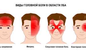 Почему болит голова в области лба и давит на глаза, как лечить неприятный симптом и предотвратить его