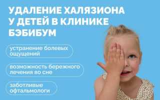 Причины и лечение халязиона у ребёнка: советы и рекомендации