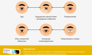 Как применяется средство Корнерегель для глаз: полезные советы и рекомендации