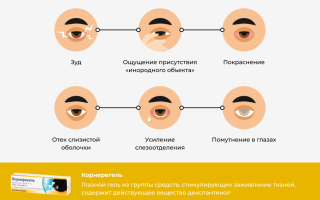 Как применяется средство Корнерегель для глаз: полезные советы и рекомендации