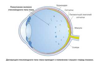 Почему возникают и как избавиться от звёздочек перед глазами: полезные советы