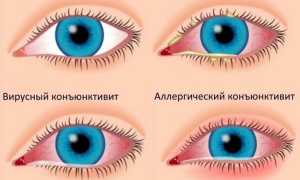 Почему у ребёнка слезится один глаз: возможные причины и рекомендации