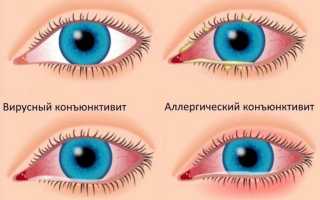 Почему у ребёнка слезится один глаз: возможные причины и рекомендации