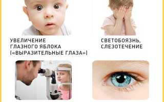 Особенности течения врождённой глаукомы у детей