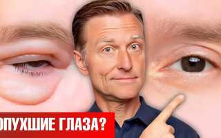 Как без операции убрать мешки под глазами навсегда