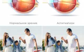 Как видит предметы человек с астигматизмом: особенности восприятия