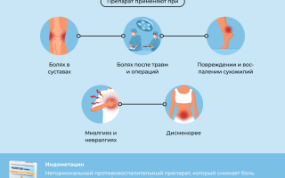 Показания и противопоказания к применению капель Индометацин для здоровья