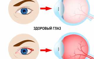 Почему щиплет глаза: причины и советы