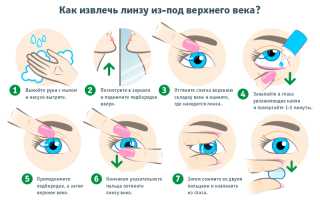 Может ли линза потеряться в глазу: важные аспекты и советы