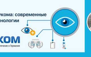 Специалисты и клиники по лечению глаукомы в Германии: профессиональный подход и современные методы