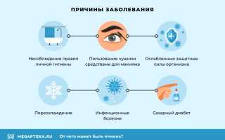 Ячмень – психосоматическая болезнь родом из детства и её причины