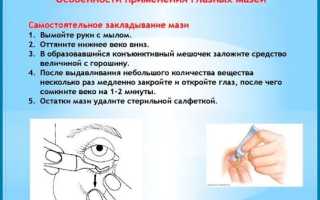 Как заложить Тетрациклиновую мазь за веко правильно и безопасно