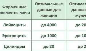 Расшифровка анализа мочи по методу Нечипоренко: норма и возможные заболевания