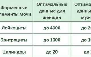 Расшифровка анализа мочи по методу Нечипоренко: норма и возможные заболевания