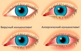 Причины глазной боли и их последствия