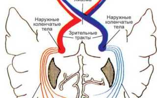 Механизм развития и коррекция гемианопсии: ключевые аспекты и рекомендации