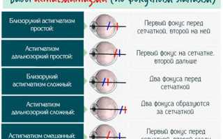 Разновидности тестов на астигматизм и их особенности