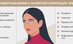 Противопоказания к лазерной коррекции зрения: важные аспекты здоровья