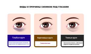 Причины появления у мужчин тёмных кругов под глазами и методы их устранения: полезные советы