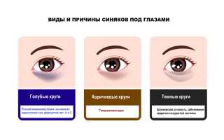 Причины появления у мужчин тёмных кругов под глазами и методы их устранения: полезные советы