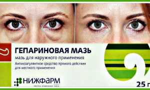 Использование Гепариновой мази для лечения отёков под глазами: советы и рекомендации
