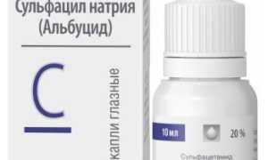 Особенности глазных капель Альбуцид для здоровья глаз