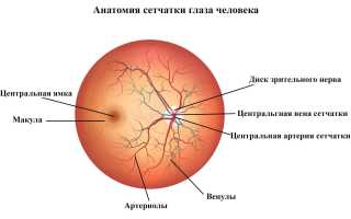 Что такое тромбоз центральной вены сетчатки и как его лечить: причины и рекомендации