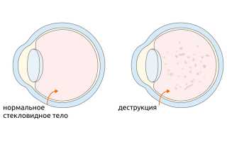 Что провоцирует появление искр из глаз, как вернуть зрение и улучшить здоровье