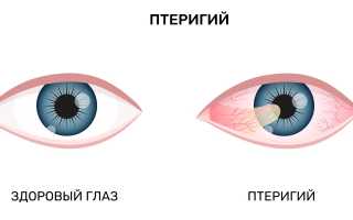 Разновидности глазных заболеваний и их симптомы