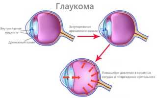 Причины давления на глаза изнутри и методы лечения патологии: советы и рекомендации