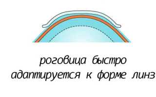 Особенности лечения астигматизма у взрослых: важные аспекты и рекомендации
