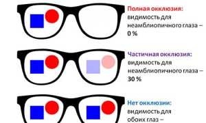 Проявление амблиопии глаза и методы корректировки зрения для улучшения качества жизни