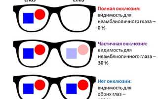 Проявление амблиопии глаза и методы корректировки зрения для улучшения качества жизни