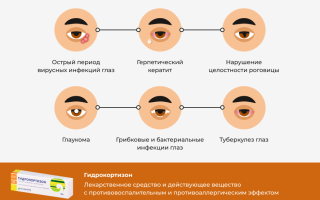 Инструкция по применению Гидрокортизоновой мази для лечения