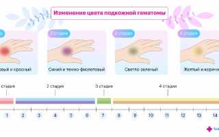 Почему долго не проходят синяки: причины и советы
