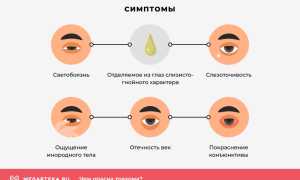 Эффективная терапия трахомы глаз для улучшения зрения