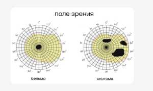 Как проводят периметрию глаза и для чего она нужна в офтальмологии