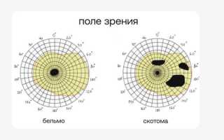 Как проводят периметрию глаза и для чего она нужна в офтальмологии