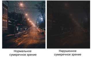 Ухудшение сумеречного зрения: причины и лечение для здоровья глаз