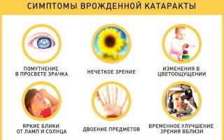 Причины, симптомы и лечение врождённой катаракты у детей: важная информация для родителей