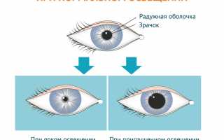 Возникновение и лечение светочувствительности глаз: причины и методы